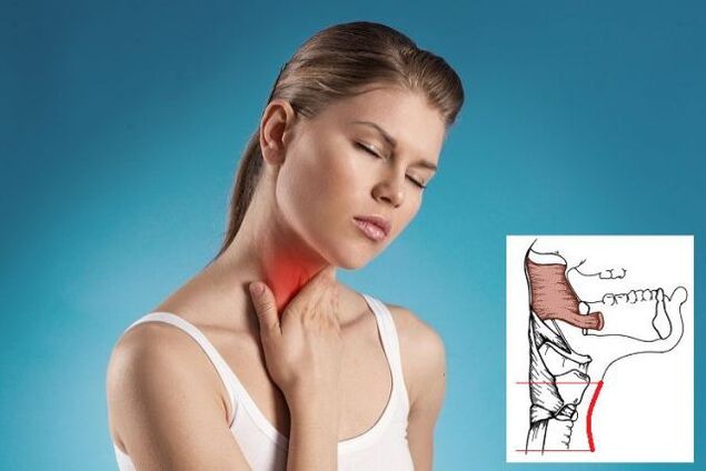 sore throat with cervical osteochondrosis