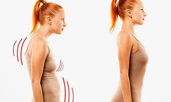 Reasons for the development of cervical osteochondrose