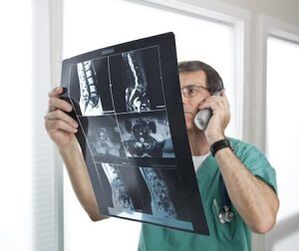 Myelogram for the diagnosis of osteochondrosis and intervertebral hernias
